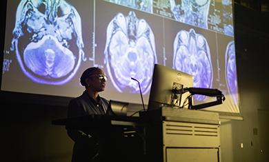 Presenter at a lectern beside a large screen showing brain MRI scans